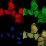 SH3PXD2A Antibody in Immunocytochemistry (ICC/IF)