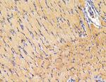 SH3PXD2A Antibody in Immunohistochemistry (Paraffin) (IHC (P))