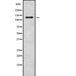 SH3PXD2A Antibody in Western Blot (WB)