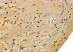 SH3BGRL3 Antibody in Immunohistochemistry (Paraffin) (IHC (P))