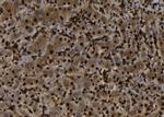 SH3BGRL Antibody in Immunohistochemistry (Paraffin) (IHC (P))