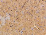 SH3BGRL Antibody in Immunohistochemistry (Paraffin) (IHC (P))