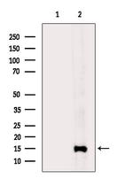 SH3BGRL Antibody in Western Blot (WB)