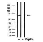 SLC6A13 Antibody in Western Blot (WB)