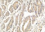 TBC1D2 Antibody in Immunohistochemistry (Paraffin) (IHC (P))