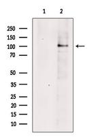 TBC1D2 Antibody in Western Blot (WB)