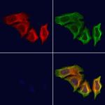 TNNT1 Antibody in Immunocytochemistry (ICC/IF)