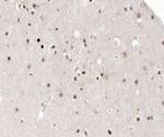 HDAC9 Antibody in Immunohistochemistry (Paraffin) (IHC (P))