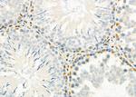 HEXIM1 Antibody in Immunohistochemistry (Paraffin) (IHC (P))