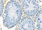 HEXIM1 Antibody in Immunohistochemistry (Paraffin) (IHC (P))