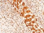 Phospho-Chk1 (Ser296) Antibody in Immunohistochemistry (Paraffin) (IHC (P))