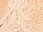 Phospho-Chk1 (Ser296) Antibody in Immunohistochemistry (Paraffin) (IHC (P))