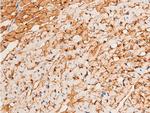 Phospho-Chk1 (Ser296) Antibody in Immunohistochemistry (Paraffin) (IHC (P))