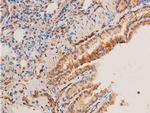 Phospho-Chk1 (Ser296) Antibody in Immunohistochemistry (Paraffin) (IHC (P))