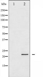 CPI-17 alpha Antibody in Western Blot (WB)