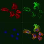 ADRM1 Antibody in Immunocytochemistry (ICC/IF)