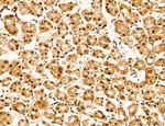 ADRM1 Antibody in Immunohistochemistry (Paraffin) (IHC (P))