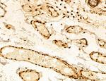 ADRM1 Antibody in Immunohistochemistry (Paraffin) (IHC (P))