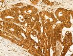 ADRM1 Antibody in Immunohistochemistry (Paraffin) (IHC (P))