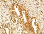 ADRM1 Antibody in Immunohistochemistry (Paraffin) (IHC (P))