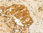 ADRM1 Antibody in Immunohistochemistry (Paraffin) (IHC (P))