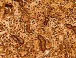 ADRM1 Antibody in Immunohistochemistry (Paraffin) (IHC (P))