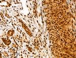 ADRM1 Antibody in Immunohistochemistry (Paraffin) (IHC (P))