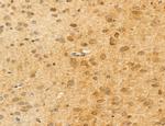 ADRM1 Antibody in Immunohistochemistry (Paraffin) (IHC (P))