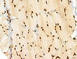 ADRM1 Antibody in Immunohistochemistry (Paraffin) (IHC (P))