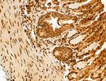 ADRM1 Antibody in Immunohistochemistry (Paraffin) (IHC (P))