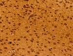 ADRM1 Antibody in Immunohistochemistry (Paraffin) (IHC (P))