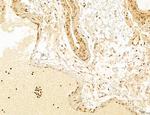 ADRM1 Antibody in Immunohistochemistry (Paraffin) (IHC (P))