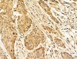 ADRM1 Antibody in Immunohistochemistry (Paraffin) (IHC (P))