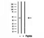 ADRM1 Antibody in Western Blot (WB)