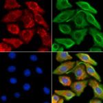 CCS Antibody in Immunocytochemistry (ICC/IF)