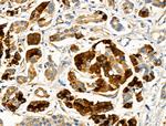 CCS Antibody in Immunohistochemistry (Paraffin) (IHC (P))