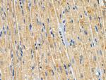 CCS Antibody in Immunohistochemistry (Paraffin) (IHC (P))