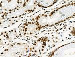 Phospho-CD227 (Mucin 1) (Tyr1229) Antibody in Immunohistochemistry (Paraffin) (IHC (P))