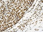 Phospho-CD227 (Mucin 1) (Tyr1229) Antibody in Immunohistochemistry (Paraffin) (IHC (P))