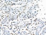 Phospho-CD227 (Mucin 1) (Tyr1229) Antibody in Immunohistochemistry (Paraffin) (IHC (P))