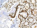 Phospho-CD227 (Mucin 1) (Tyr1229) Antibody in Immunohistochemistry (Paraffin) (IHC (P))