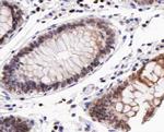 Phospho-CD227 (Mucin 1) (Tyr1229) Antibody in Immunohistochemistry (Paraffin) (IHC (P))