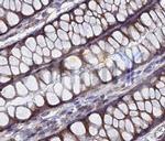 TGF alpha Antibody in Immunohistochemistry (Paraffin) (IHC (P))