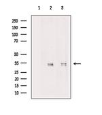 MBD3 Antibody in Western Blot (WB)