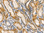 TNFAIP8 Antibody in Immunohistochemistry (Paraffin) (IHC (P))