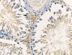 TNFAIP8 Antibody in Immunohistochemistry (Paraffin) (IHC (P))