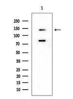 HGK Antibody in Western Blot (WB)