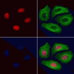 Phospho-GATA1 (Ser310) Antibody in Immunocytochemistry (ICC/IF)