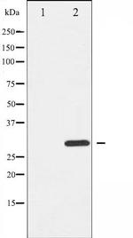 Phospho-BIK (Thr33) Antibody in Western Blot (WB)