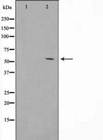 BMP-5 Antibody in Western Blot (WB)